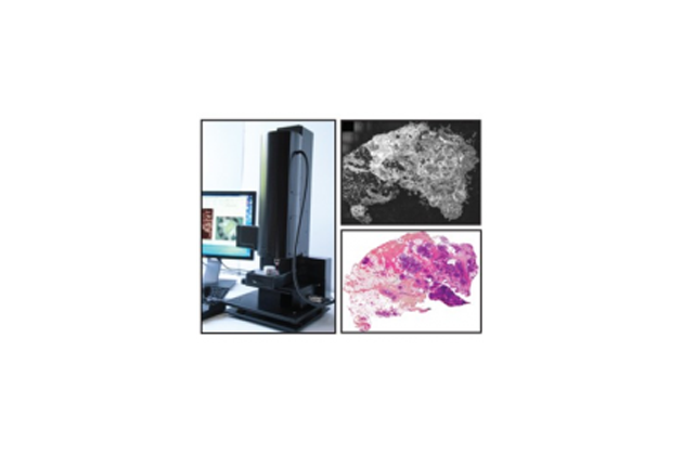 Сенсоры CMOSIS продолжают борьбу с раком, став частью эндоскопической камеры для обнаружения раковых образований